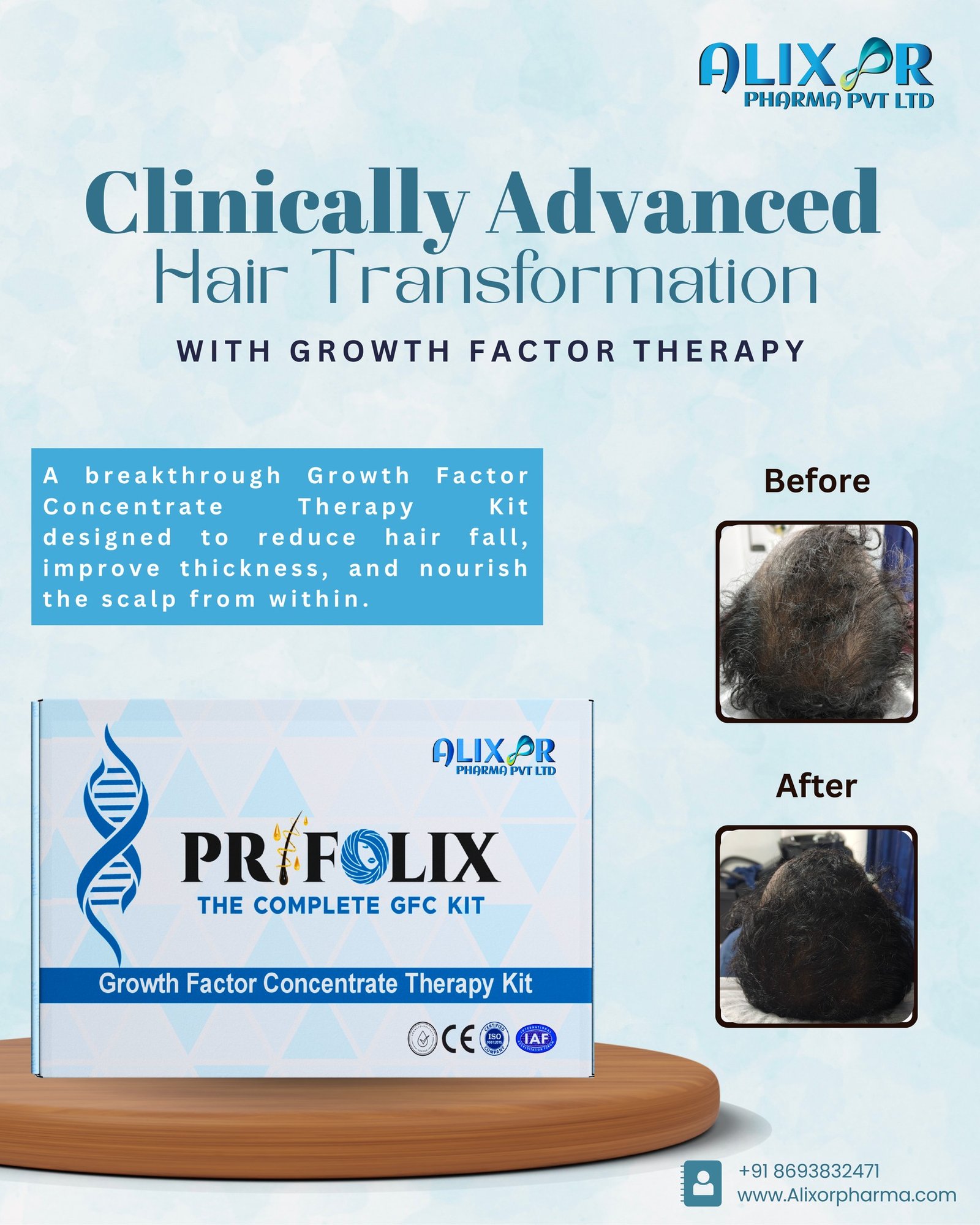 β¨ Transform Your Hair from Within β¨
Say goodbye to hair fall & thinning with the Prifolix Complete GFC Kit β a clinically advanced Growth Factor Concentrate Therapy designed to:β
 Reduce Hair Fall
β
 Improve Hair Thickness
β
 Nourish the Scalp from WithinπΈ Real Results. Real Confidence.π +91 8693832471
π www.alixorpharma.com#Prifolix #HairGrowth #GFCtherapy #HairFallSolution #HairCare #AlixorPharma #HairTransformation